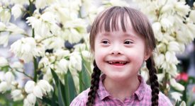 sindrome-di-down
