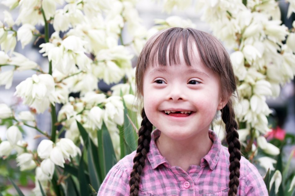 sindrome-di-down