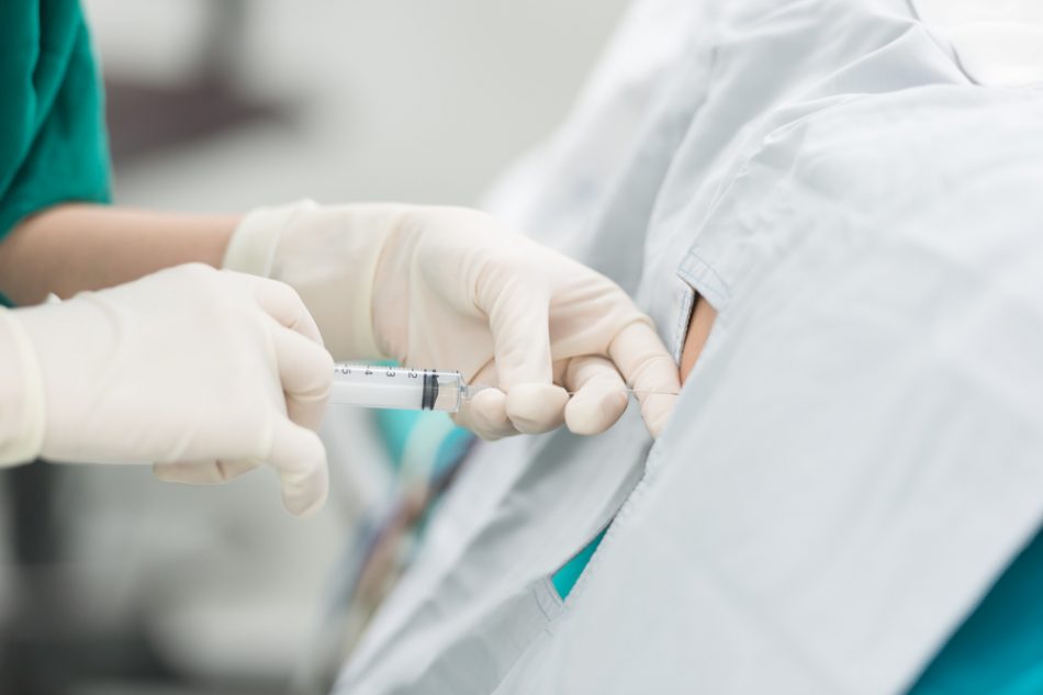 il-parto-con-lanestesia-epidurale