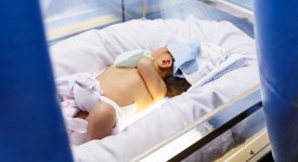bilirubina-alta-neonato-cosa-significa