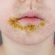 impetigine