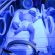 ittero-neonatale-quando-e-fisiologico-o-patologico