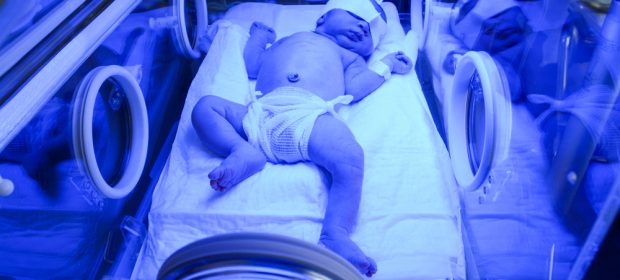ittero-neonatale-quando-e-fisiologico-o-patologico
