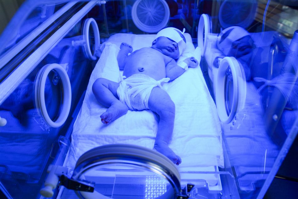 ittero-neonatale-quando-e-fisiologico-o-patologico