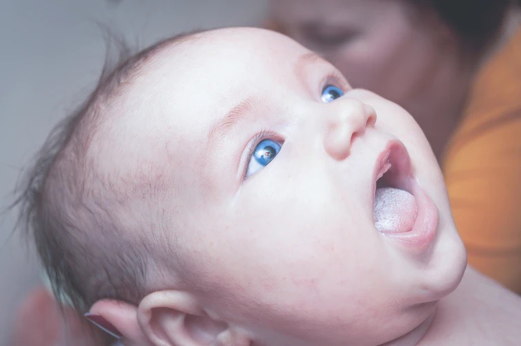 afte-nel-bambino-cosa-fare