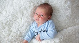 rimedi-naturali-dermatite-bambini