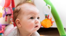 craniostenosi-bambino-sintomi-intervento