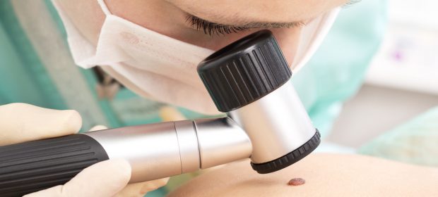 melanoma-piu-aggressivo-in-gravidanza