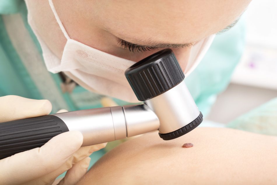 melanoma-piu-aggressivo-in-gravidanza