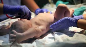 neonato-con-malformazione-alladdome-viene-salvato-da-un-intervento-innovativo