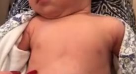 la-bronchiolite-di-una-bambina-in-un-video-diventato-virale-video