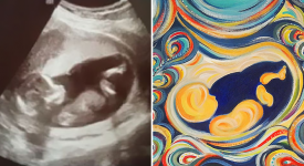 le-ecografie-delle-future-mamme-diventano-quadri-lidea-dellartista-laura-steerman