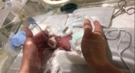 pesava-solo-268-ma-ora-sta-bene-il-bambino-piu-piccolo-del-mondo-e-a-casa