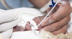 prematuri-grazie-ai-mini-sensori-sara-piu-facile-tenerli-in-braccio
