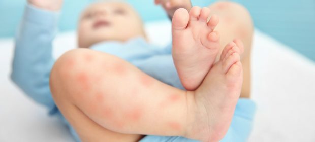come-difendere-neonati-dalle-zanzare