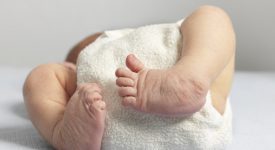piede-torto-nel-neonato-cose-e-come-si-cura