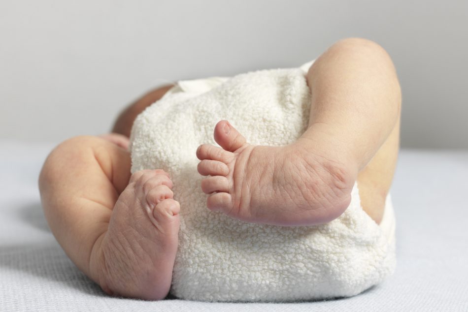 piede-torto-nel-neonato-cose-e-come-si-cura