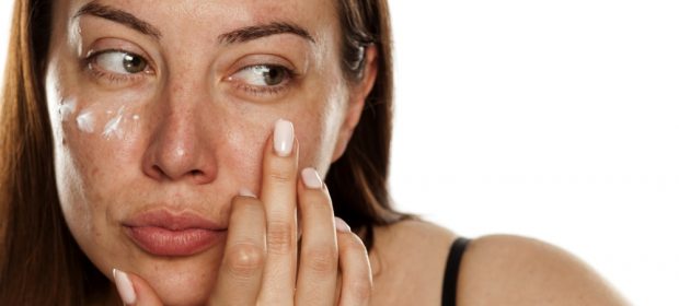 come-prevenire-maschera-gravidica