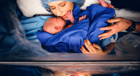 parto-cesareo-sempre-piu-mamme-americane-scelgono-il-telo-trasparente