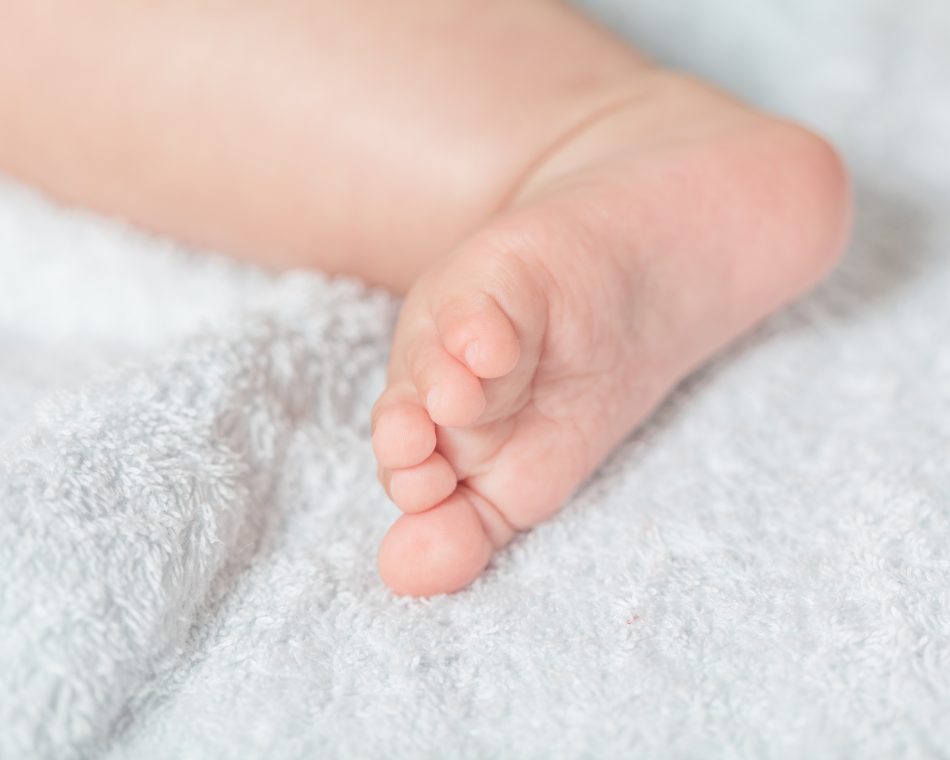 bimba-indiana-nasce-con-4-gambe-e-3-mani-presto-lintervento