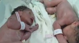 albania-due-gemelli-vengono-alla-luce-poco-dopo-il-sisma