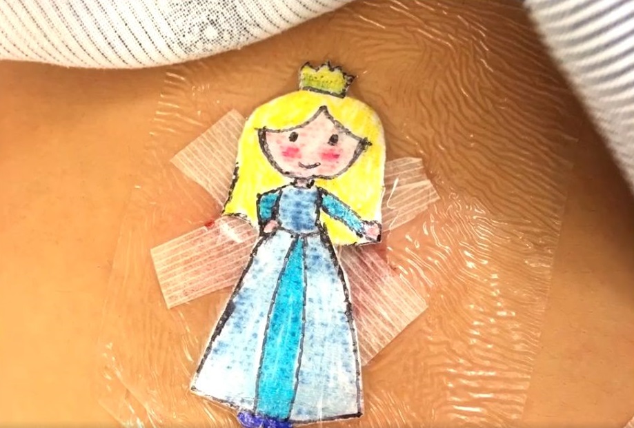 disegni-sulle-medicazioni-dei-bimbi-l'idea-di-un-medico-dopo-le-operazioni-chirurgiche