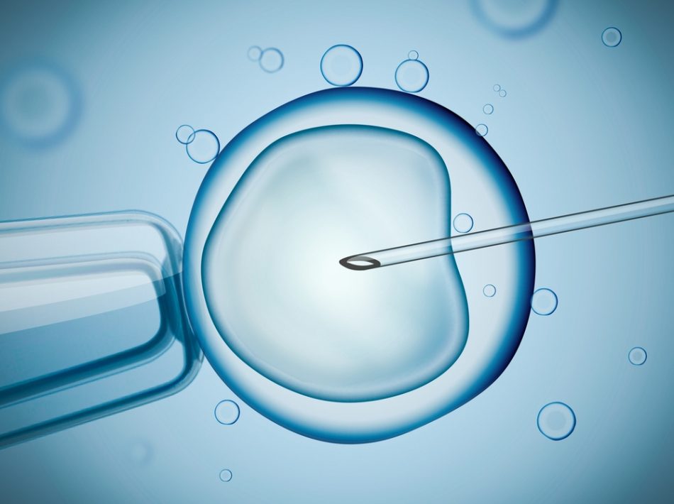sterile-dopo-la-chemio-ha-dato-alla-luce-un-figlio-grazie-alla-maturazione-in-vitro