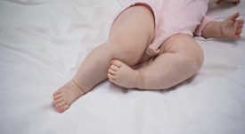 sinechie-delle-piccole-labbra-bimbe