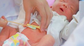 la-medicazione-del-cordone-ombelicale-come-farlo-a-casa