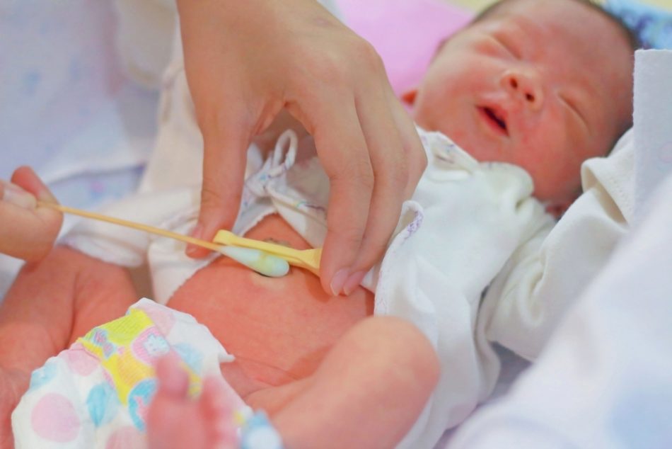 la-medicazione-del-cordone-ombelicale-come-farlo-a-casa