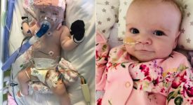 piccoli-combattenti:-la-storia-di-erin,-neonata-cardiopatica-che-ha-sconfitto-il-coronavirus