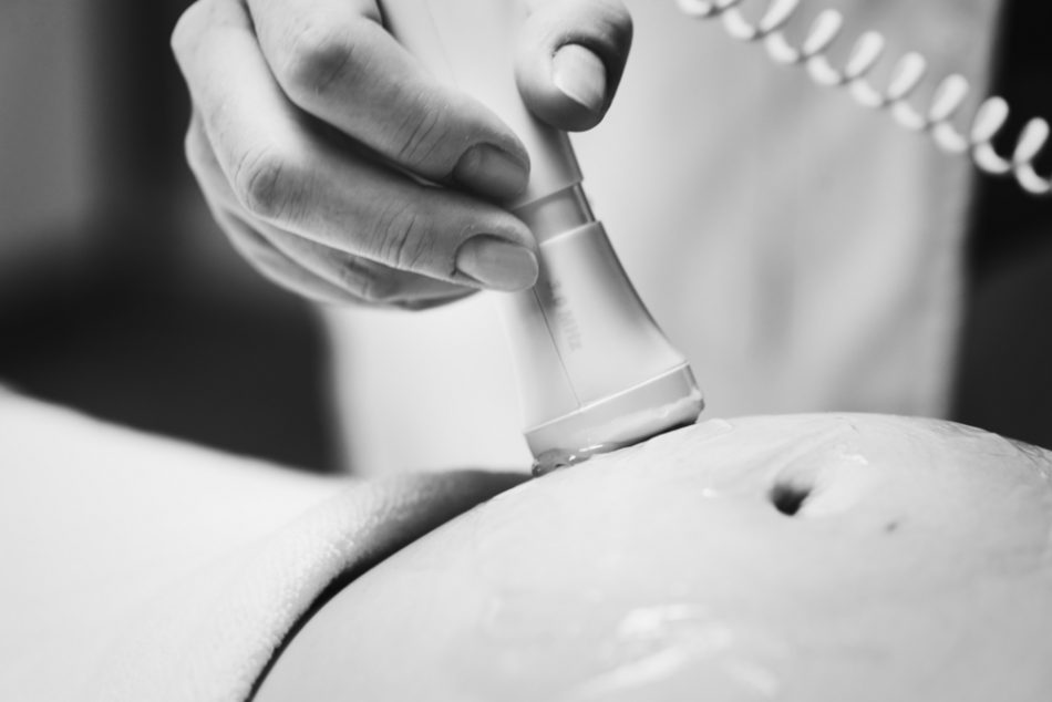 bambin-gesu:-operato-in-utero-feto-di-sole-28-settimane