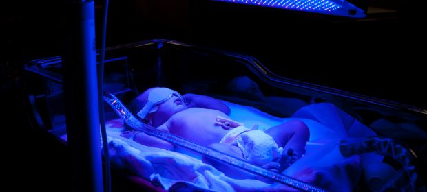 ittero-neonatale-informazioni