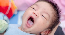 lingua-bianca-del-neonato