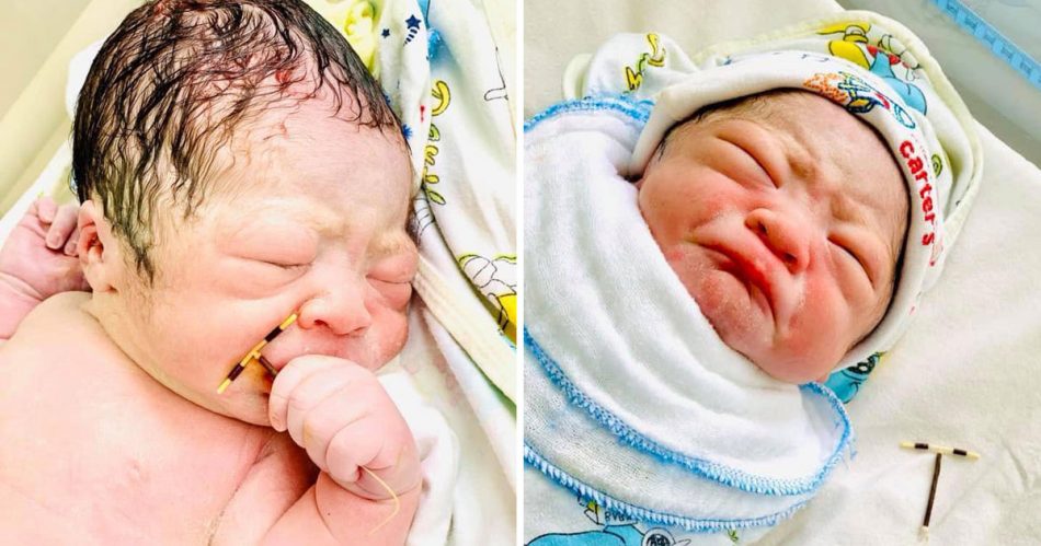 nasce-nonostante-la-spirale-la-foto-del-neonato-che-stringe-nelle-mani-il-contraccettivo-della-madre-fa-il-giro-del-web
