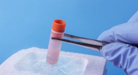social-freezing-la-conservazione-di-ovociti