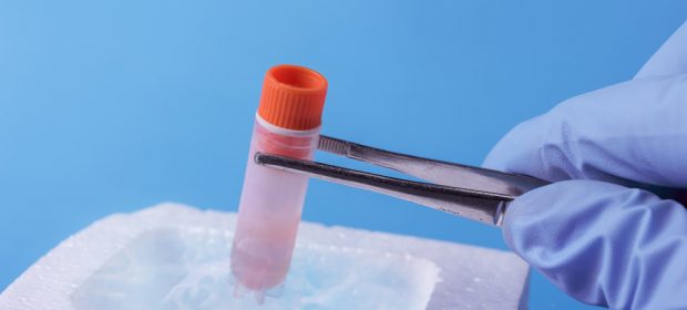 social-freezing-la-conservazione-di-ovociti