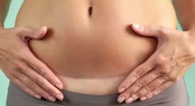 taglio-cesareo:-come-curare-la-cicatrice
