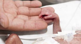 intervento-record-a-novara-operato-neonato-prematuro-di-soli-1000-gr