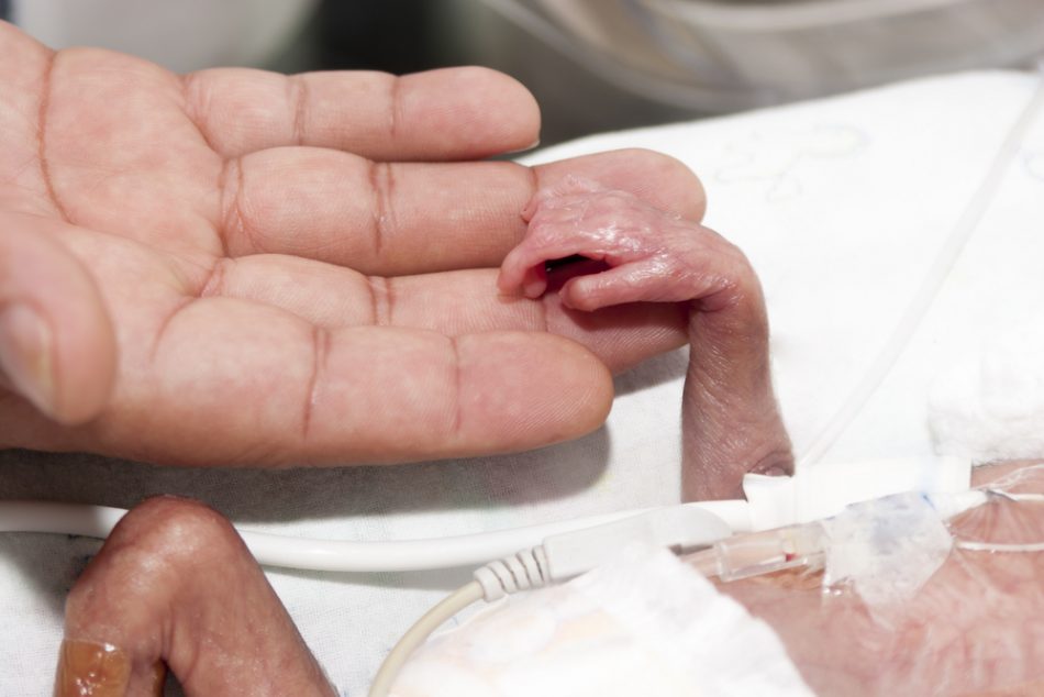 intervento-record-a-novara-operato-neonato-prematuro-di-soli-1000-gr