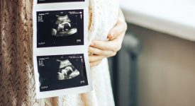 triplicato-il-numero-dei-bambini-nati-morti-nel-lockdown-il-pericolo-delle-visite-saltate