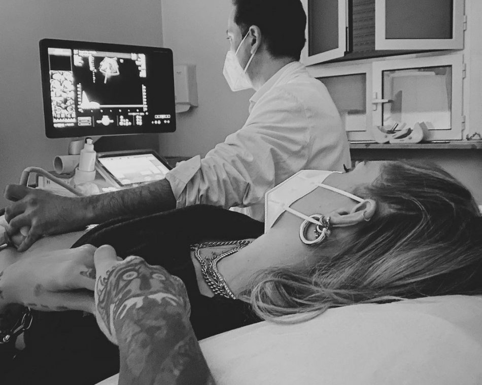 gravidanza-e-norme-anti-covid-fedez-accompagna-chiara-ellecografia-e-polemica-sui-social