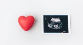 non-fatemi-sentire-il-cuore
