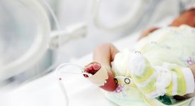 trisomia-13-o-sindrome-di-patau-cose-cause-sintomi-e-prognosi