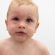 shock-anafilattico-nei-bambini-cose-e-come-si-manifesta